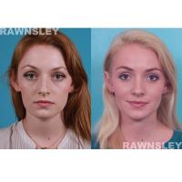 Rawnsley Plastic Surgery image 4